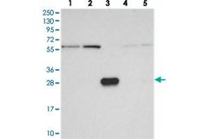 Western blot analysis of Lane 1: RT-4, Lane 2: U-251 MG, Lane 3: Human Plasma, Lane 4: Liver, Lane 5: Tonsil with KIAA1128 polyclonal antibody  at 1:250-1:500 dilution. (FAM190B Antikörper)