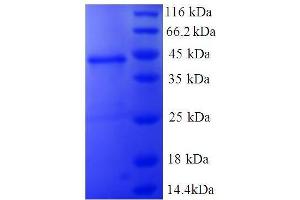 SDS-PAGE (SDS) image for Non-Metastatic Cells 1, Protein (NM23A) Expressed in (NME1) (AA 2-152), (full length) protein (GST tag) (ABIN7479605) (NME1 Protein (AA 2-152, full length) (GST tag))