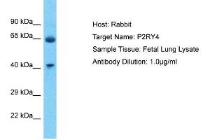 Host: Rabbit Target Name: P2RY4 Sample Type: Fetal Lung lysates Antibody Dilution: 1.