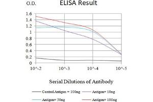 Black line: Control Antigen (100 ng),Purple line: Antigen (10 ng), Blue line: Antigen (50 ng), Red line:Antigen (100 ng) (SARS-CoV-2-NP3 (AA 240-419) Antikörper)