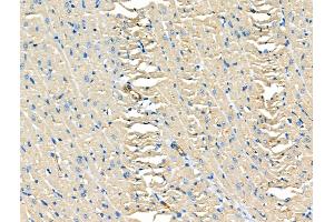 ABIN6261836 and ABIN6266759 at 1/100 staining Rat heart tissue by IHC-P.