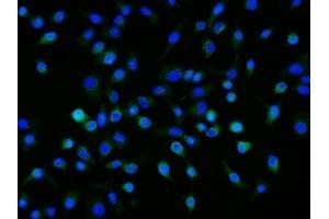 IF analysis of Neuropilin 1 using anti-Neuropilin 1 antibody (ABIN7601921). (Neuropilin 1 Antikörper  (AA 504-827))