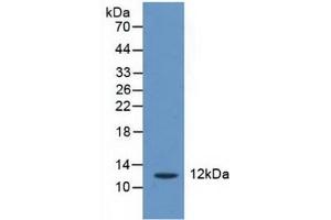 Detection of CRADD in Human Liver Tissue using Polyclonal Antibody to CASP2 And RIPK1 Domain Containing Adaptor With Death Domain Protein (CRADD) (CRADD Antikörper  (AA 1-199))