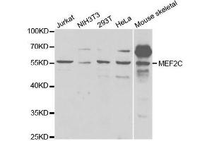 Western blot analysis of extracts of various cell lines, using MEF2C antibody. (MEF2C Antikörper  (AA 170-380))