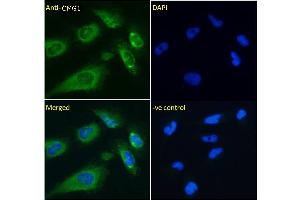 ABIN6391342 Immunofluorescence analysis of paraformaldehyde fixed U251 cells, permeabilized with 0. (IFT74 Antikörper)