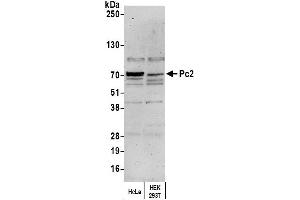 Western Blotting (WB) image for anti-Proprotein Convertase Subtilisin/kexin Type 2 (PCSK2) (AA 150-200) antibody (ABIN7454823)
