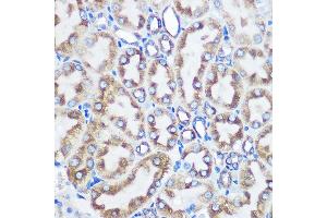 Immunohistochemistry (IHC) image for anti-Lysyl Oxidase (LOX) antibody (ABIN7268347)