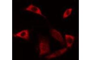 ABIN6275523 staining Hela cells by IF/ICC. (Septin 6 Antikörper  (Internal Region))