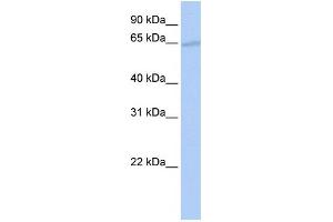 WB Suggested Anti-GATAD2B Antibody Titration:  0. (GATAD2B Antikörper  (N-Term))