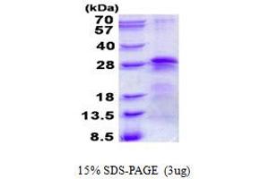 Image no. 1 for Basic Transcription Factor 3 (BTF3) (AA 1-206) protein (His tag) (ABIN6387098)