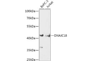 Western blot analysis of extracts of various cell lines, using DN antibody (ABIN7266825) at 1:1000 dilution. (DNAJC18 Antikörper  (AA 260-350))