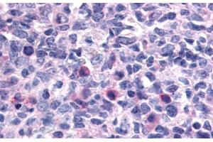 Anti-CXCR1 antibody  ABIN1048469 IHC staining of human lymph node. (CXCR1 Antikörper  (N-Term))