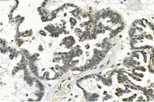 IHC analysis of PHEX using anti-PHEX antibody (ABIN7600072). (PHEX Antikörper  (AA 145-718))