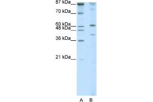 WB Suggested Anti-REXO4 Antibody Titration:  1. (REXO4 Antikörper  (N-Term))