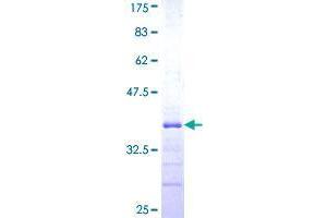 RNF141 Protein (AA 141-229) (GST tag)