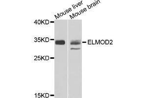 Western blot analysis of extracts of mouse liver and moues brain using ELMOD2 antibody. (ELMOD2 Antikörper)