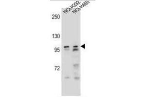 AR Antibody (Center) western blot analysis in NCI-H292,NCI-H460 cell line lysates (35µg/lane). (Androgen Receptor Antikörper  (Middle Region))