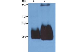 Western Blotting analysis (non-reducing conditions) of whole cell lysate of HPB-ALL human peripheral blood T cell leukemia cell line using anti-CD59 (MEM-43/5). (CD59 Antikörper)
