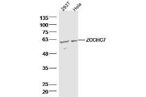 Lane 1: 293T lysates Lane 2: hela lysates probed with ZCCHC7 Polyclonal Antibody, Unconjugated  at 1:300 dilution and 4˚C overnight incubation. (ZCCHC7 Antikörper  (AA 401-500))