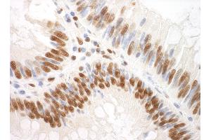 anti-Splicing Factor 3a, Subunit 3, 60kDa (SF3A3) (AA 451-501) antibody