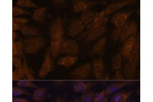 Immunofluorescence analysis of C6 cells using TXNRD1 Polyclonal Antibody at dilution of 1:100. (TXNRD1 Antikörper)