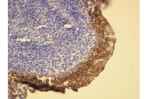 Immunohistochemistry (IHC) image for anti-Keratin 5/6 (KRT5/6) (AA 548-564), (C-Term) antibody (ABIN7598763) (Keratin 5/6 Antikörper  (C-Term))