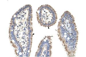 KRT2A antibody was used for immunohistochemistry at a concentration of 4-8 ug/ml to stain Epithelial cells of intestinal villus (arrows) in Human Intestine. (Keratin 2 Antikörper  (Middle Region))