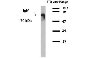 Western blotting detection (reducing conditions) of IgM in human plasma using anti-human IgM (CH2) peroxidase conjugate. (Maus anti-Human IgM Antikörper (HRP))