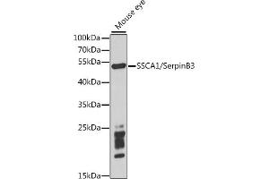 Western blot analysis of extracts of mouse eye, using SSC/SerpinB3 antibody (ABIN6131348, ABIN6147587, ABIN6147588 and ABIN6221070) at 1:1000 dilution. (SERPINB3 Antikörper  (AA 1-230))