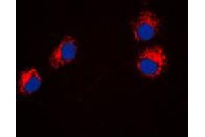 Immunofluorescent analysis of Semaphorin 4A staining in HeLa cells.