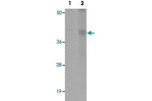Western blot analysis of rat liver tissue with CALHM1 polyclonal antibody  at (Lane 1) 1 and (Lane 2) 2 ug/mL dilution. (CALHM1 Antikörper  (N-Term))