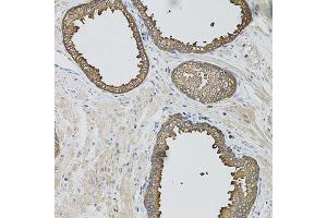 Immunohistochemistry of paraffin-embedded human prostate using CASP12 antibody. (Caspase 12 Antikörper)