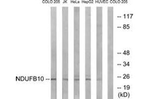 Western blot analysis of extracts from COLO/Jurkat/HeLa/HepG2/HuvEc cells, using NDUFB10 Antibody. (NDUFB10 Antikörper  (AA 63-112))