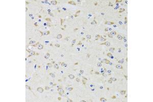 Immunohistochemistry of paraffin-embedded rat brain using YWHAZ antibody (ABIN5975846) at dilution of 1/100 (40x lens). (14-3-3 zeta Antikörper)