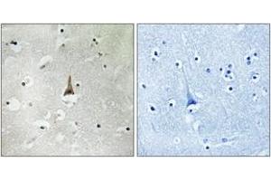 Immunohistochemistry (IHC) image for anti-Low Density Lipoprotein Receptor Related Protein 10 (LRP10) (AA 204-253) antibody (ABIN2890399) (LRP10 Antikörper  (AA 204-253))