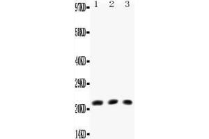 Anti-TNF beta antibody, All Western blottingAll lanes: Anti-TNF beta at 0.