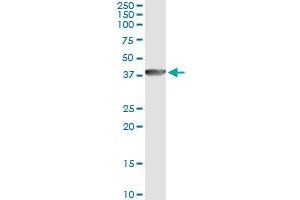 Western Blotting (WB) image for anti-DnaJ (Hsp40) Homolog, Subfamily B, Member 6 (DNAJB6) (AA 72-172) antibody (ABIN523423)