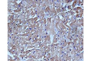 Immunohistochemistry (IHC) image for anti-Caspase 3 (CASP3) (N-Term) antibody (ABIN6260474)