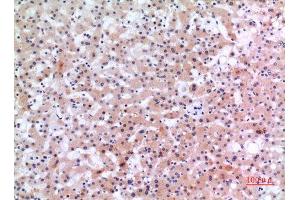 Immunohistochemistry (IHC) analysis of paraffin-embedded Human Liver, antibody was diluted at 1:100.