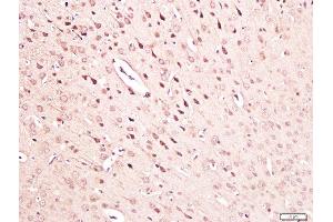 Paraformaldehyde-fixed, paraffin embedded mouse brain tissue, Antigen retrieval by boiling in sodium citrate buffer(pH6) for 15min, Block endogenous peroxidase by 3% hydrogen peroxide for 30 minutes, Blocking buffer (normal goat serum) at 37°C for 20min, Antibody incubation with Rabbit Anti-NGF Polyclonal Antibody, Unconjugated  at 1:300 overnight at 4°C, followed by a conjugated secondary and DAB staining (NGFB Antikörper  (AA 151-220))