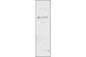 Image no. 1 for anti-Glutathione S Transferase (GST) antibody (ABIN226631) (GST Antikörper)