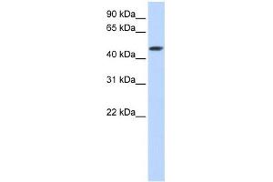 SULT2B1 antibody used at 1 ug/ml to detect target protein. (SULT2B1 Antikörper  (C-Term))