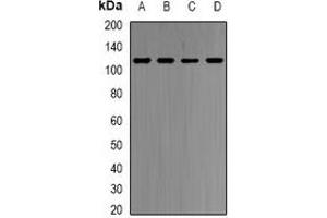 Western blot analysis of HMGCR expression in HepG2 (A), Hela (B), mouse spleen (C), rat liver (D) whole cell lysates.