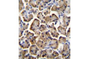 Immunohistochemistry (IHC) image for anti-Betacellulin (BTC) antibody (ABIN2996306) (Betacellulin Antikörper)