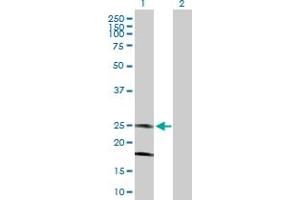 Western Blot analysis of KCNMB4 expression in transfected 293T cell line by KCNMB4 MaxPab polyclonal antibody.