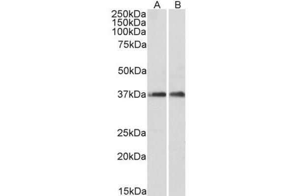 ARPC1A Antikörper  (C-Term)