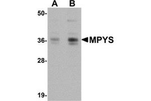 Western Blotting (WB) image for anti-Transmembrane Protein 173 (TMEM173) (C-Term) antibody (ABIN1030523) (STING/TMEM173 Antikörper  (C-Term))