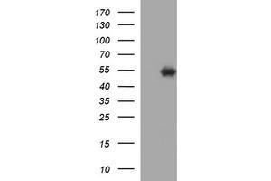 Image no. 1 for anti-Tubulin, beta 1 (TUBB1) antibody (ABIN1501570) (TUBB1 Antikörper)
