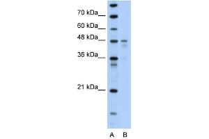 PDK4 antibody used at 1 ug/ml to detect target protein.