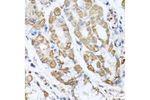 Immunohistochemistry of paraffin-embedded human stomach using ANTXR2 antibody (ABIN5975032) at dilution of 1/100 (40x lens). (ANTXR2 Antikörper)